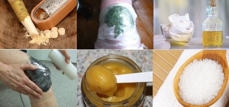 العلاجات المنزلية لالتهاب المفاصل في مفصل الركبة