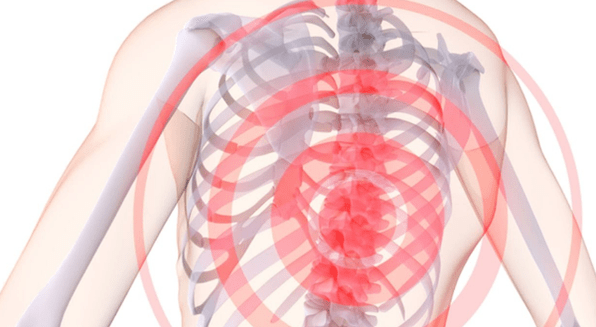 ألم في العمود الفقري مع الداء العظمي الغضروفي الصدري